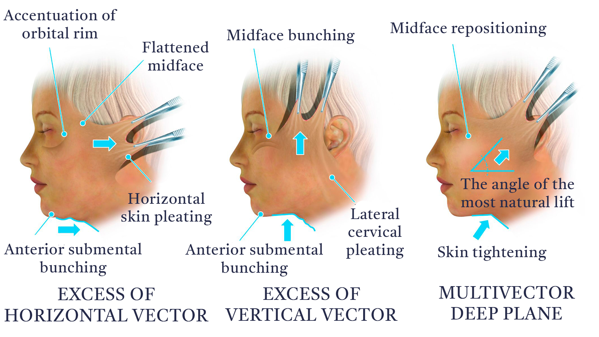 Vectores-EN