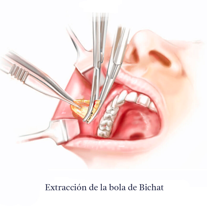 Bichectomia-Anatomia-C