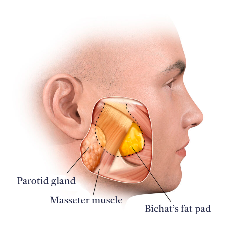 Bichectomy-Anatomy-A