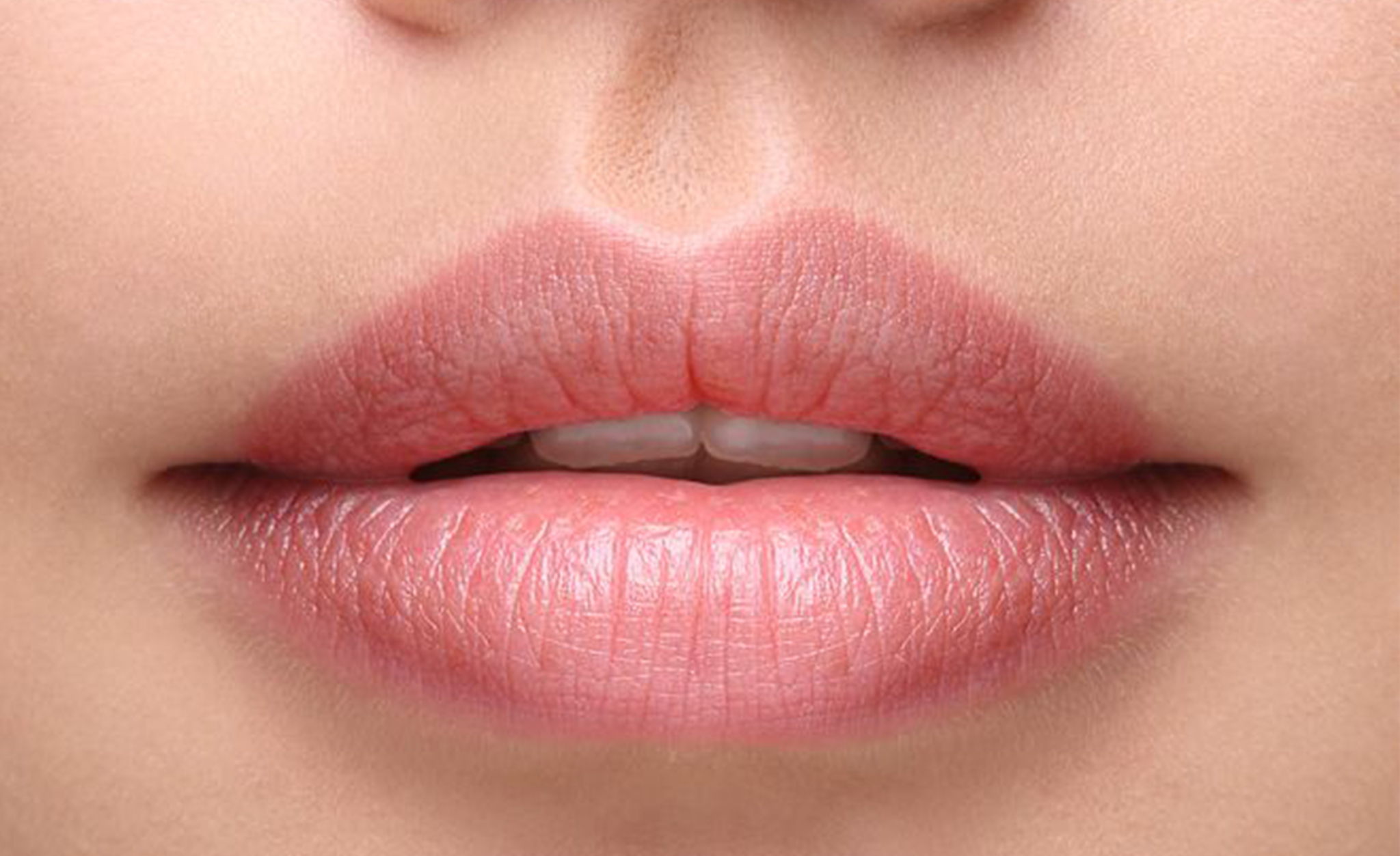 liplift2.jpg