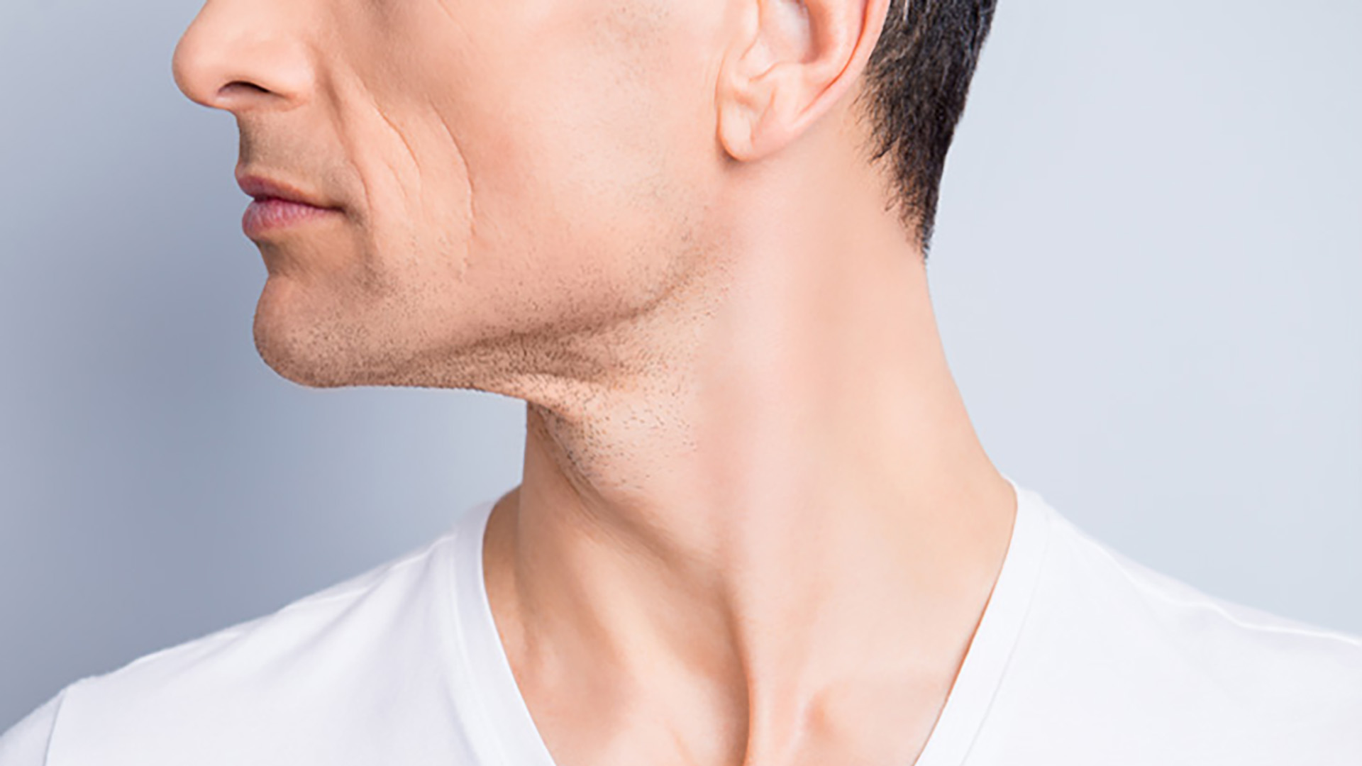 Lifting-cervicofacial-hombre