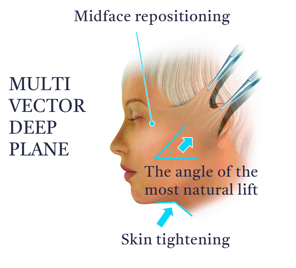 MultiVector