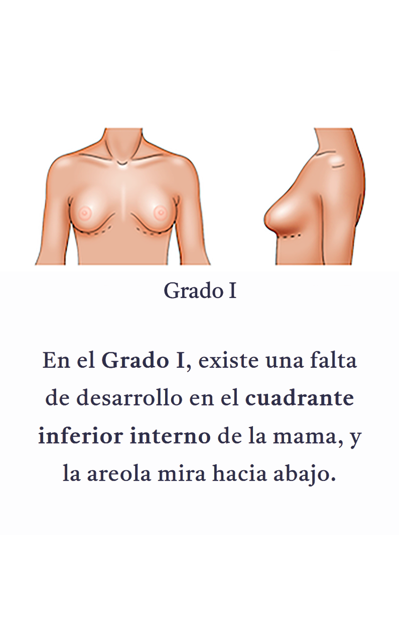 Grado 1 Movil