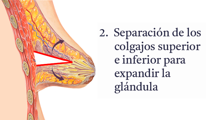 cirugia-2