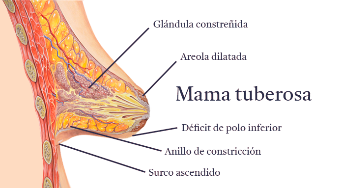 mama-tuberosa